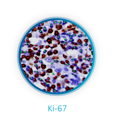 Intraoperative Consultation