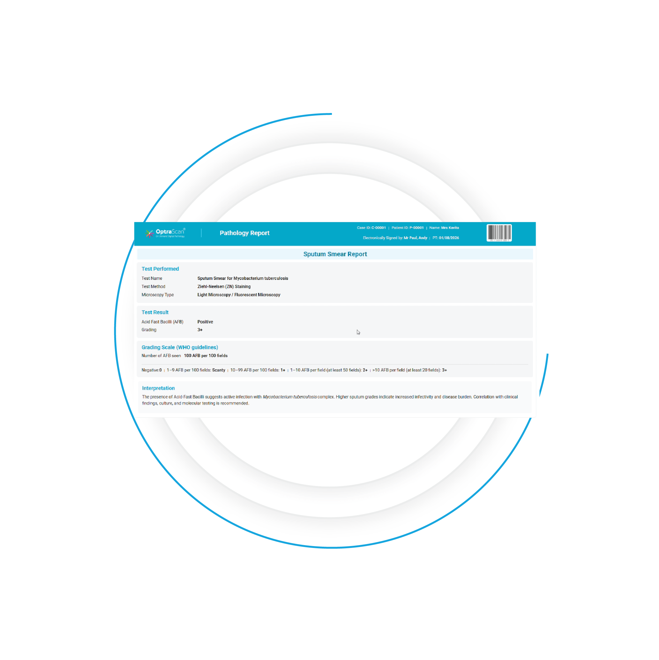 OS-FS Frozen Section Slide Scanner