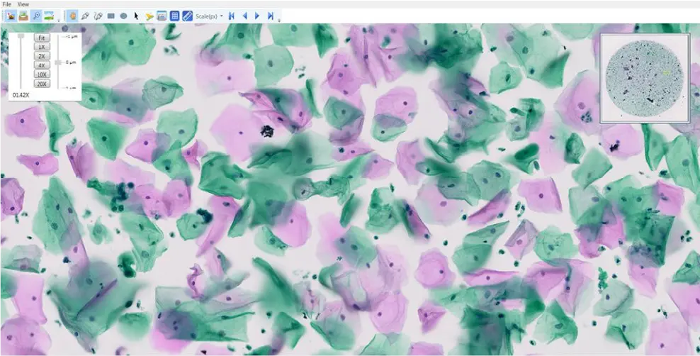 Cytology Slide Scanner Analysis