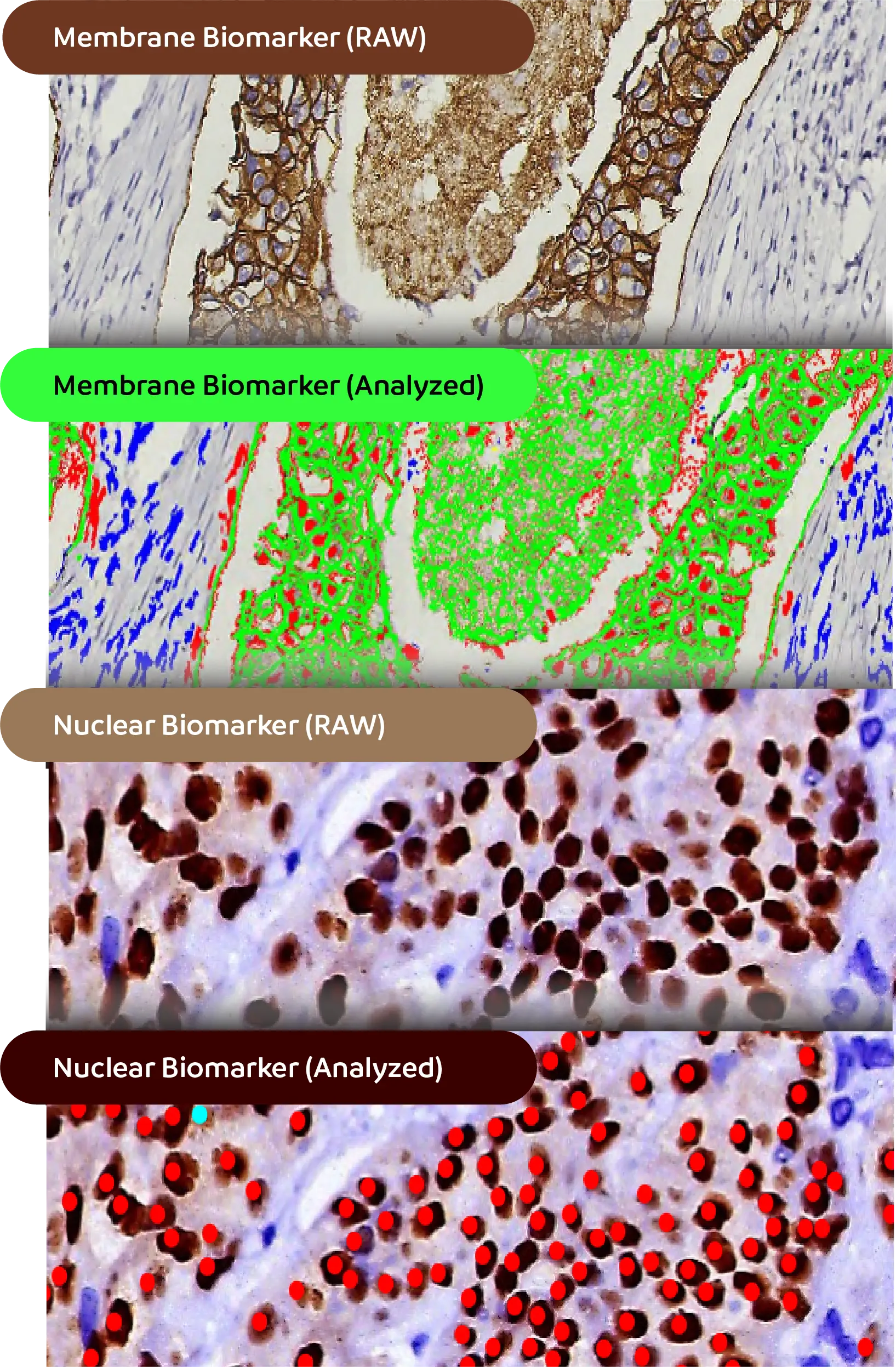 Scanned with AI Digital Pathology Scanner
